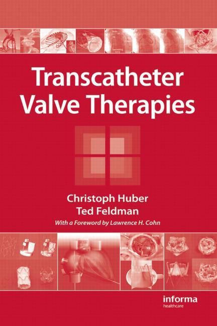 Transcatheter Valve Therapies - Ingram